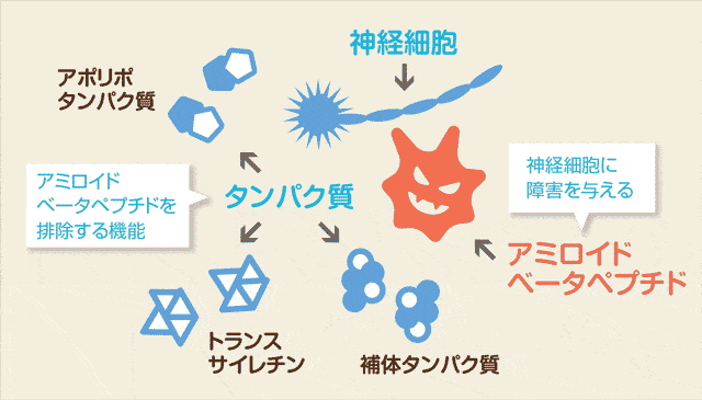 MCIスクリーニング検査の図解