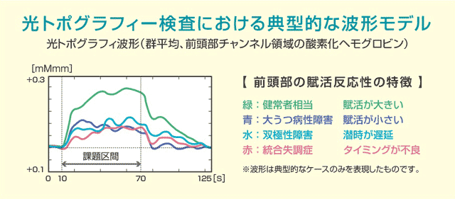 光トポグラフィー検査における典型的な波形モデル 
